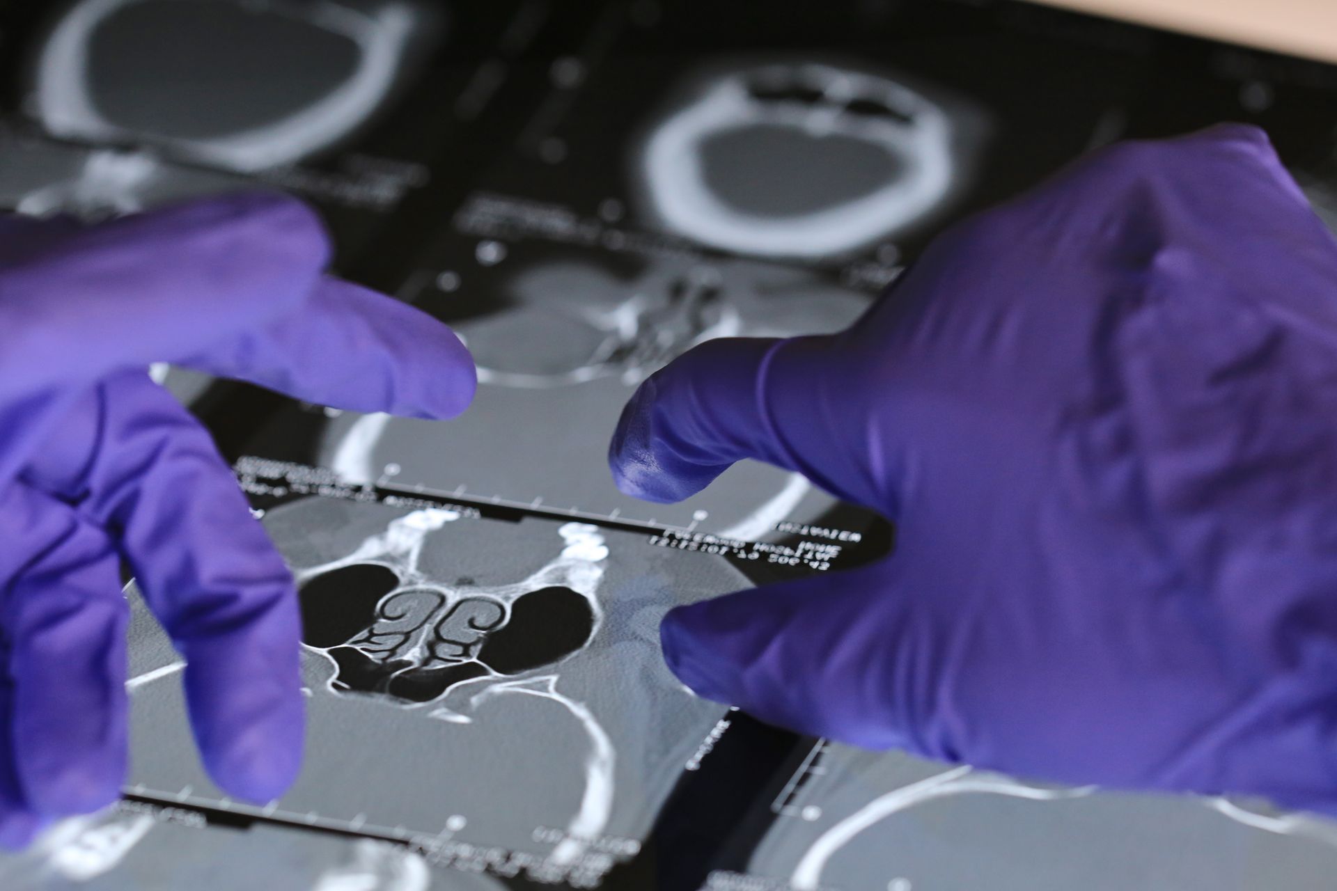 La FDA vient d'approuver l'IA pour prédire les résultats à long terme du cancer.