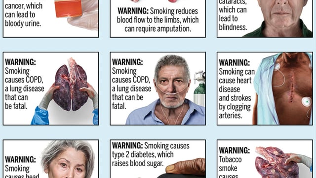Requiring ugly images of smoking's harm on cigarettes won't breach First  Amendment, court says